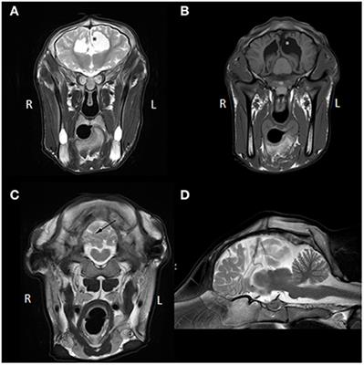 Case Report: Complex Congenital Brain Anomaly in a BBxHF Calf–Clinical Signs, Magnetic Resonance Imaging, and Pathological Findings